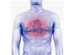 Balloon Angioplasty in Kolkata